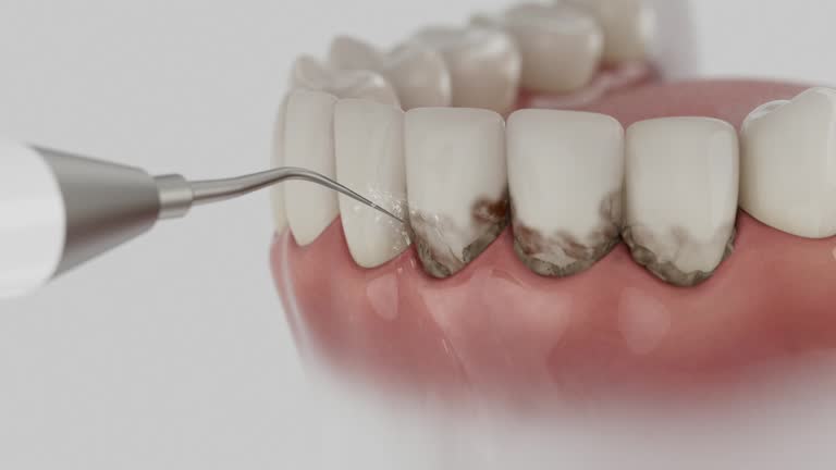 Reliable Dental Implants contractor in Okmulgee, OK by Smile Center Dentistry